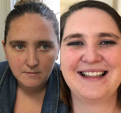 Allday Secure Tandproteslim