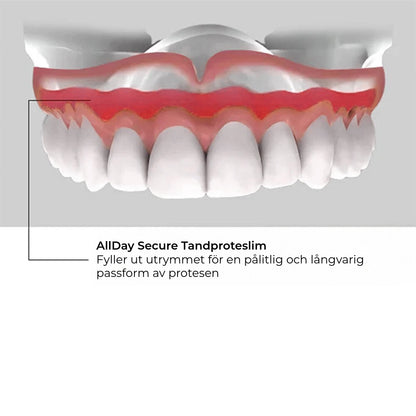Allday Secure Tandproteslim