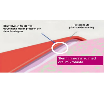 Allday Secure Tandproteslim